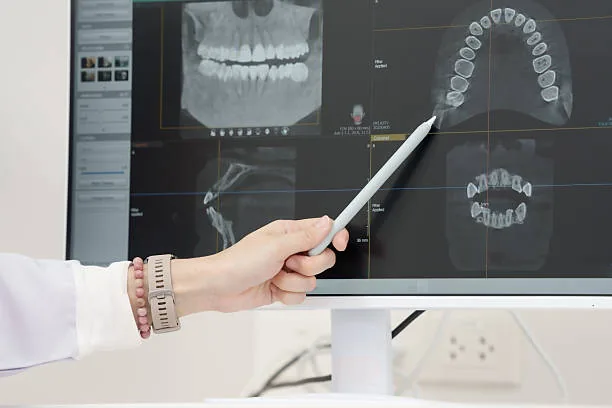 Radiographie panoramique dentaire consultée par la dentiste