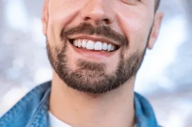 Sourire naturel et éclatant après un soin esthétique dentaire